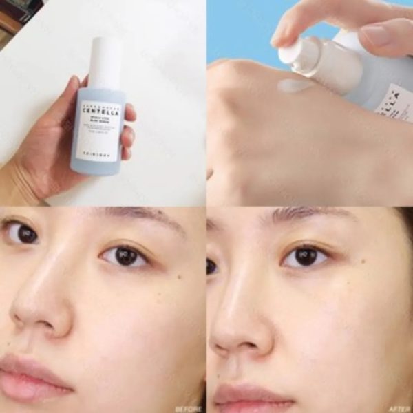 Skin1004 Madagascar Centella Hyalu-Cica Blue Serum - 30ml Supply